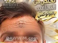 خدمة حقن بوتوكس - دمشق