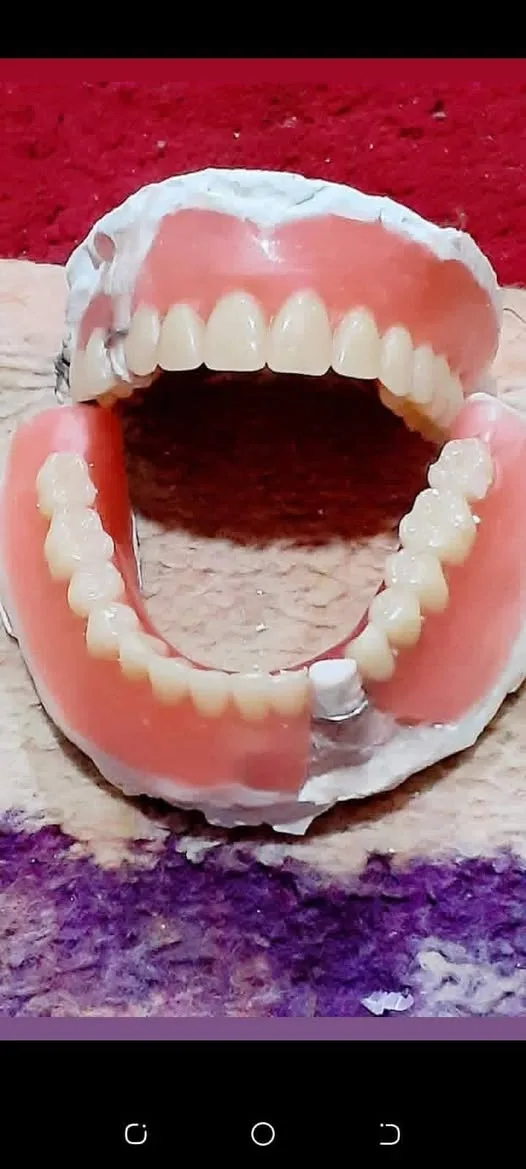 خدمة تركيب وتلبيس الأسنان مع خدمة منزلية