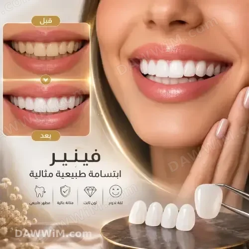 خدمة تبييض الأسنان بالليزر - ابتسامة هوليوود