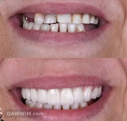 خدمات تركيبات أسنان وعناية منزلية في الحسكة
