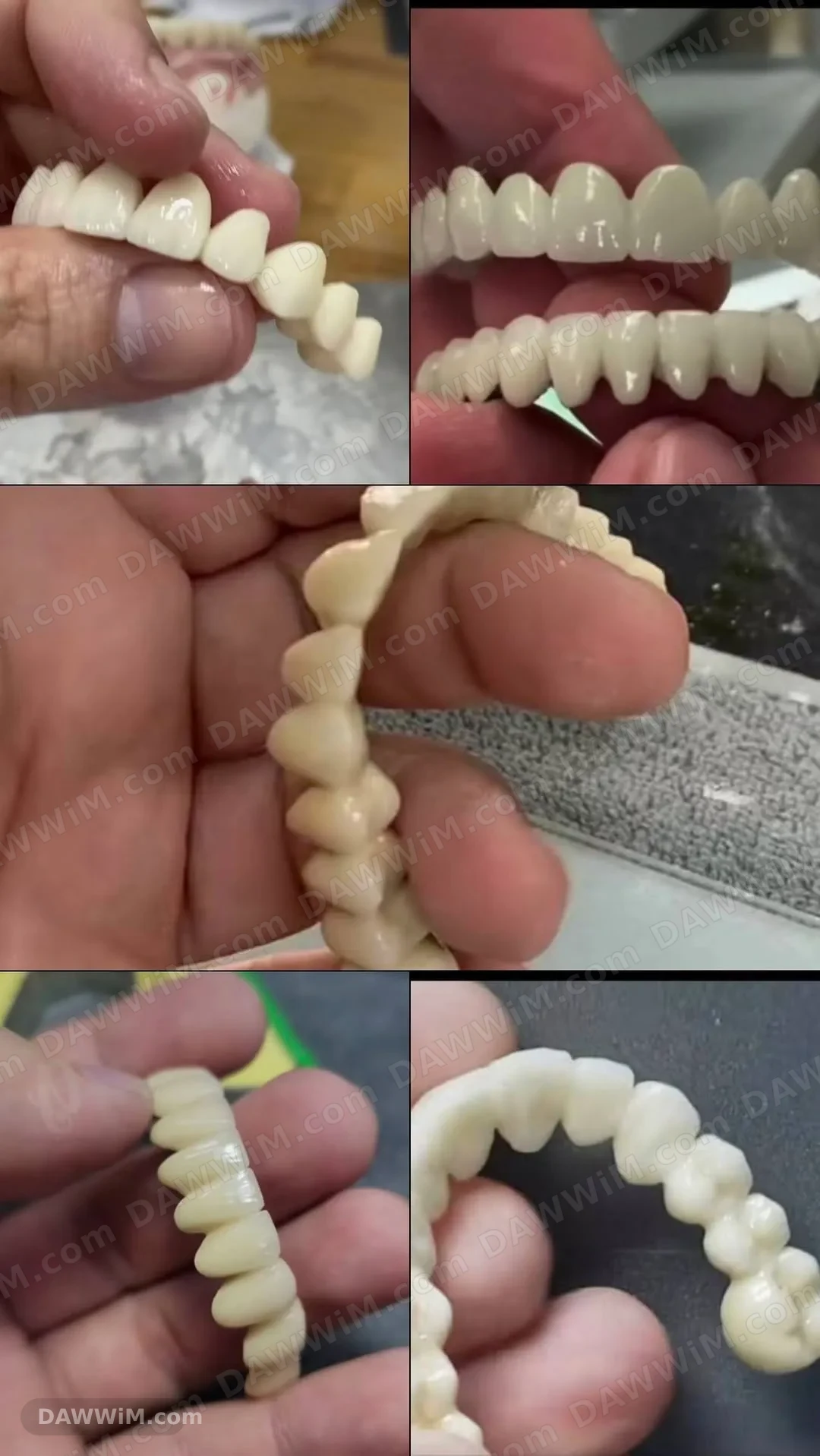 خدمات تجميل وتركيب الأسنان
