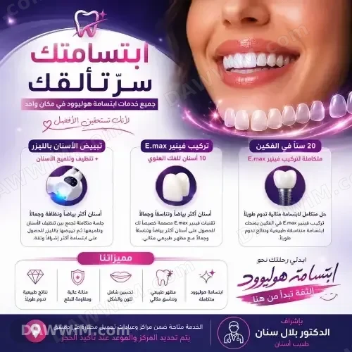 خدمات تبييض أسنان وتجميل ابتسامة هوليود