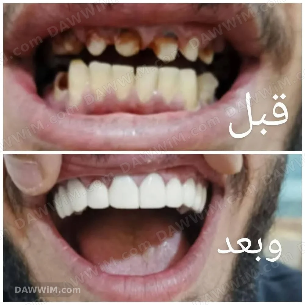 مختبر تركيب وتجميل أسنان في الحسكة