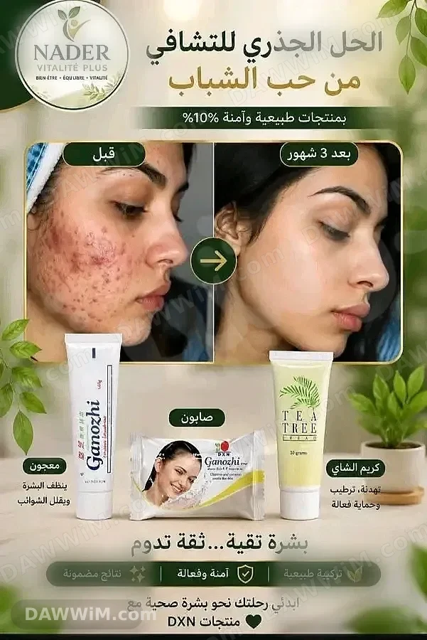 معجون أسنان جانوزي DXN
