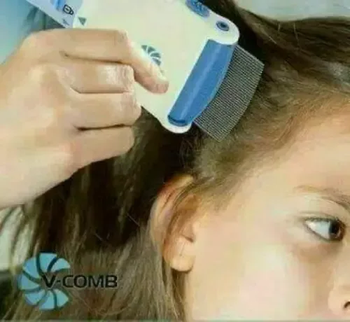 جهاز كهربائي لسحب القمل V-COMB